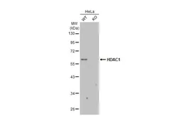 Anti-HDAC1 antibody [HL1691] used in Western Blot (WB). GTX637290