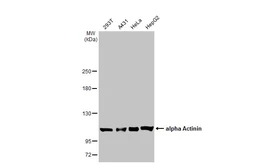 Anti-alpha Actinin antibody [HL1692] used in Western Blot (WB). GTX637291