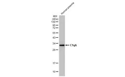 Anti-C1qA antibody [HL1695] used in Western Blot (WB). GTX637294
