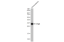 Anti-C1qA antibody [HL1695] used in Western Blot (WB). GTX637294