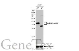 Anti-hnRNP A2B1 antibody [HL1706] used in Western Blot (WB). GTX637305