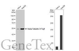 Anti-beta Tubulin 3/ Tuj1 antibody [HL1708] used in Western Blot (WB). GTX637307