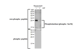 Anti-Phospholamban (phospho Ser16) antibody [HL1710] used in Western Blot (WB). GTX637309
