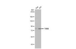 Anti-TAB2 antibody [HL1712] used in Western Blot (WB). GTX637311