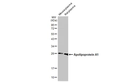 Anti-Apolipoprotein A1 antibody [HL1713] used in Western Blot (WB). GTX637312