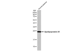 Anti-Apolipoprotein A1 antibody [HL1713] used in Western Blot (WB). GTX637312