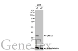 Anti-LASS2 antibody [HL1717] used in Western Blot (WB). GTX637316