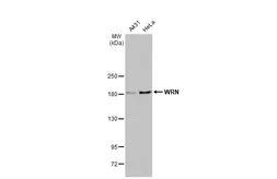 Anti-WRN antibody [HL1729] used in Western Blot (WB). GTX637377