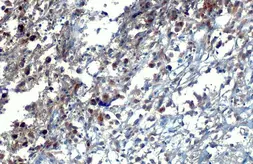 Anti-WRN antibody [HL1729] used in IHC (Paraffin sections) (IHC-P). GTX637377