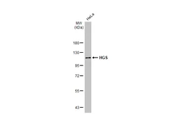Anti-HGS antibody [HL1730] used in Western Blot (WB). GTX637378