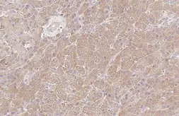 Anti-HGS antibody [HL1730] used in IHC (Paraffin sections) (IHC-P). GTX637378