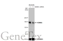 Anti-KDM6A antibody [HL1731] used in Western Blot (WB). GTX637379