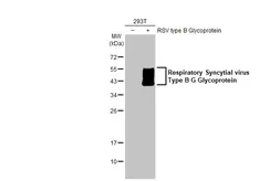 Anti-Respiratory Syncytial virus type B G protein antibody [HL1733] used in Western Blot (WB). GTX637381