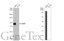 Anti-HHIP antibody [HL1737] used in Western Blot (WB). GTX637385