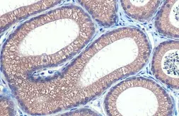 Anti-HHIP antibody [HL1737] used in IHC (Paraffin sections) (IHC-P). GTX637385