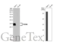 Anti-TREM2 antibody [HL1738] used in Western Blot (WB). GTX637386