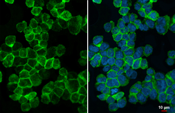 Anti-TREM2 antibody [HL1738] used in Immunocytochemistry/ Immunofluorescence (ICC/IF). GTX637386