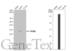 Anti-TREM2 antibody [HL1739] used in Western Blot (WB). GTX637387