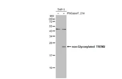 Anti-TREM2 antibody [HL1739] used in Western Blot (WB). GTX637387