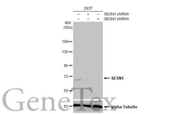 Anti-SESN1 antibody [HL1750] used in Western Blot (WB). GTX637400