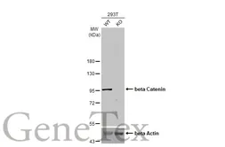 Anti-beta Catenin antibody [HL1753] used in Western Blot (WB). GTX637403