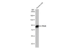 Anti-PIGR antibody [HL1757] used in Western Blot (WB). GTX637407