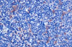 Anti-IL18 antibody [HL1761] used in IHC (Paraffin sections) (IHC-P). GTX637411