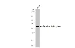 Anti-Tyrosine Hydroxylase antibody [HL1762] used in Western Blot (WB). GTX637412