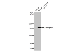 Anti-Collagen II antibody [HL1772] used in Western Blot (WB). GTX637424