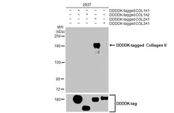 Anti-Collagen II antibody [HL1772] used in Western Blot (WB). GTX637424