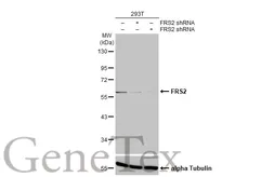 Anti-FRS2 antibody [HL1774] used in Western Blot (WB). GTX637426