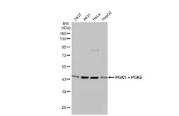 Anti-PGK1 + PGK2 antibody [HL1775] used in Western Blot (WB). GTX637427