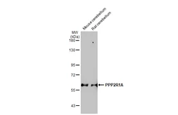 Anti-PPP2R1A antibody [HL1781] used in Western Blot (WB). GTX637433