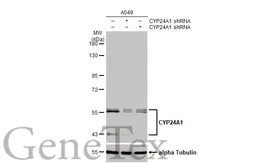 Anti-CYP24A1 antibody [HL1783] used in Western Blot (WB). GTX637435