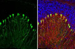 Anti-Calbindin + Calretinin antibody [HL1787] used in IHC (Paraffin sections) (IHC-P). GTX637439