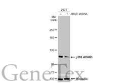 Anti-ADAR1 antibody [HL1789] used in Western Blot (WB). GTX637441