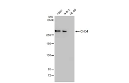 Anti-CHD4 antibody [HL1798] used in Western Blot (WB). GTX637450