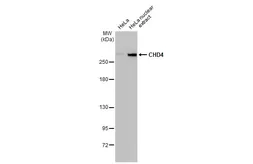 Anti-CHD4 antibody [HL1798] used in Western Blot (WB). GTX637450