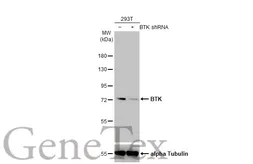 Anti-BTK antibody [HL1803] used in Western Blot (WB). GTX637455
