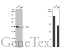 Anti-FLI1 antibody [HL1805] used in Western Blot (WB). GTX637457