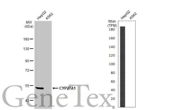 Anti-CYP27A1 antibody [HL1819] used in Western Blot (WB). GTX637544
