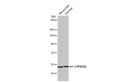 Anti-CYP27A1 antibody [HL1820] used in Western Blot (WB). GTX637545
