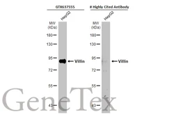 Anti-Villin antibody [HL1830] used in Western Blot (WB). GTX637555
