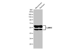 Anti-CaMKII antibody [HL1831] used in Western Blot (WB). GTX637556