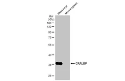 Anti-CRALBP antibody [HL1834] used in Western Blot (WB). GTX637559