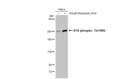 Anti-ATR (phospho Thr1989) antibody [HL1835] used in Western Blot (WB). GTX637560