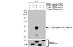Anti-SEK1 / MKK4 antibody [HL1839] used in Western Blot (WB). GTX637564