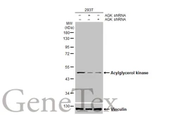 Anti-Acylglycerol kinase antibody [HL1846] used in Western Blot (WB). GTX637571