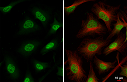 Anti-Nurr1 antibody [HL1852] used in Immunocytochemistry/ Immunofluorescence (ICC/IF). GTX637577