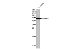 Anti-TRIM72 antibody [HL1853] used in Western Blot (WB). GTX637578